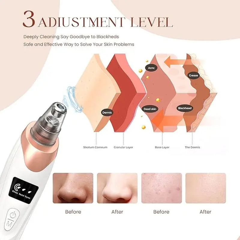 2024 Newest Blackhead Remover Pore Vacuum,Facial Pore Cleaner-5 Suction Power,5 Probes,Usb Rechargeable Blackhead Vacuum Kit Electric Acne Extractor Tool for Adult，Delivery 3-7 Days